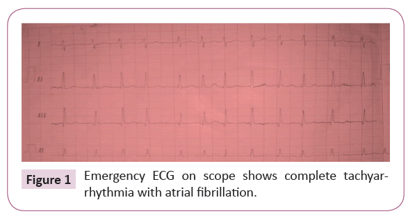 cardiovascular-investigations-open-access-atrial-fibrillation