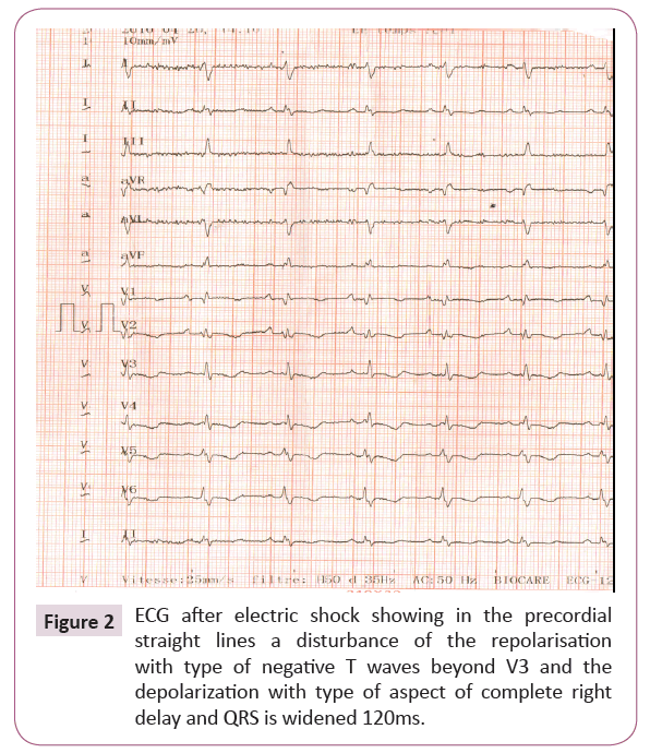 cardiovascular-investigations-open-access-complete-right