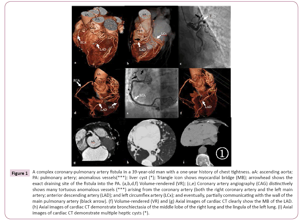 cardiovascular-investigations-open-access-coronary-pulmonary