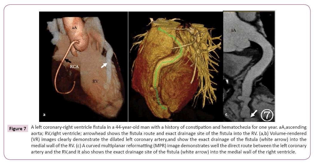 cardiovascular-investigations-open-access-demonstrates