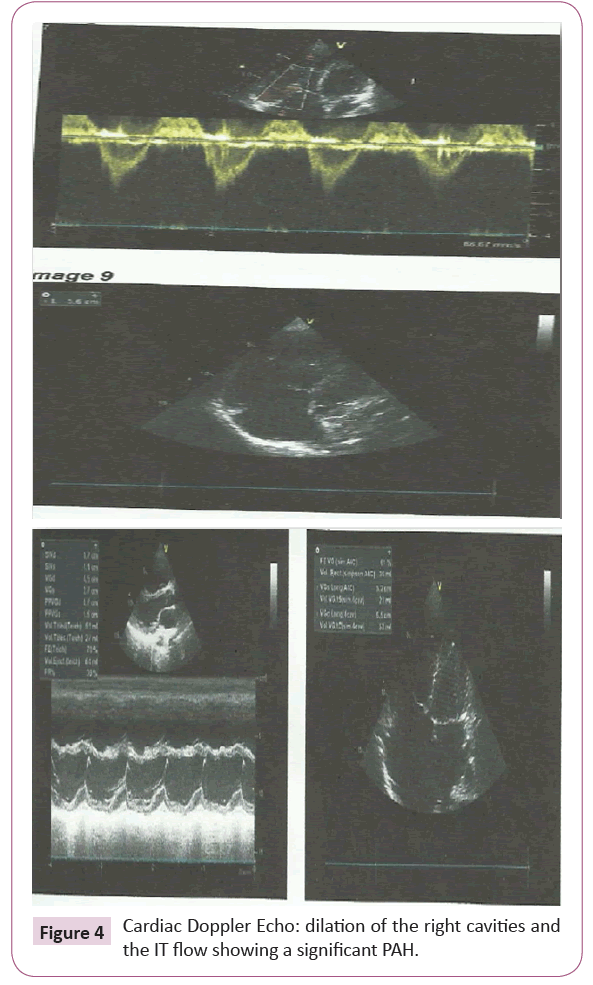 cardiovascular-investigations-open-access-right-cavities