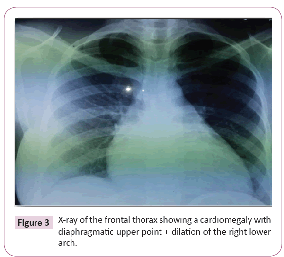 cardiovascular-investigations-open-access-right-lower