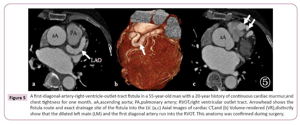 cardiovascular-investigations-open-access-right-ventricle
