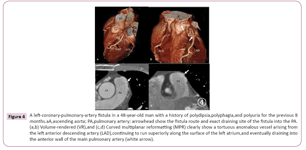 cardiovascular-investigations-open-access-year-old