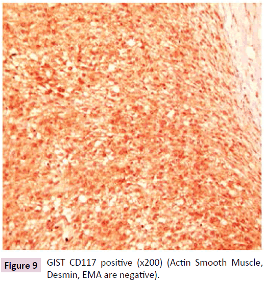 clinical-epigenetics-Actin-Smooth-Muscle