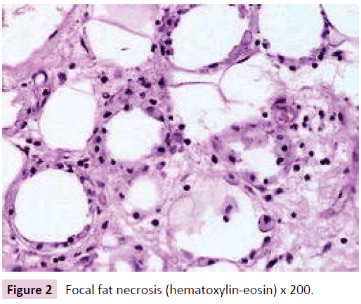 clinical-epigenetics-Focal-fat-necrosis