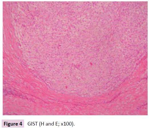 clinical-epigenetics-GIST