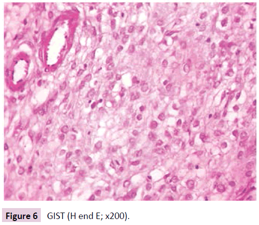 clinical-epigenetics-GIST