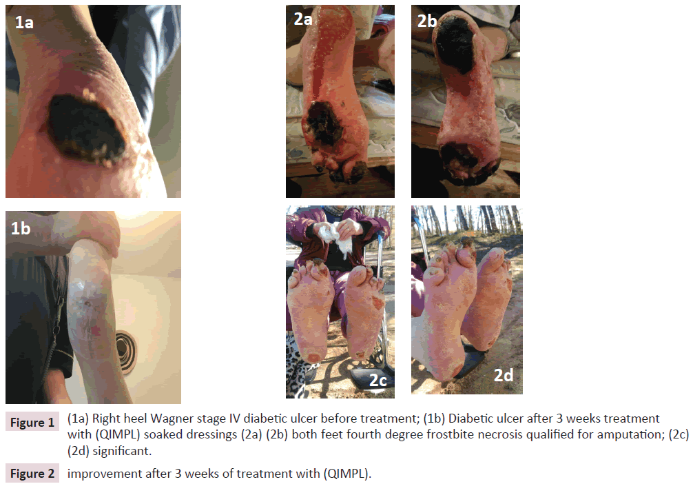 clinical-epigenetics-Right-heel-Wagner