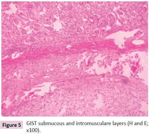 clinical-epigenetics-intromusculare-layers