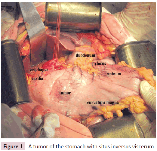 clinical-epigenetics-inversus-viscerum