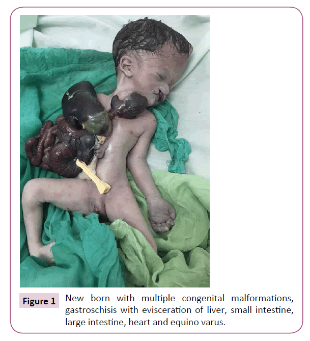 clinical-epigenetics-multiple-congenital