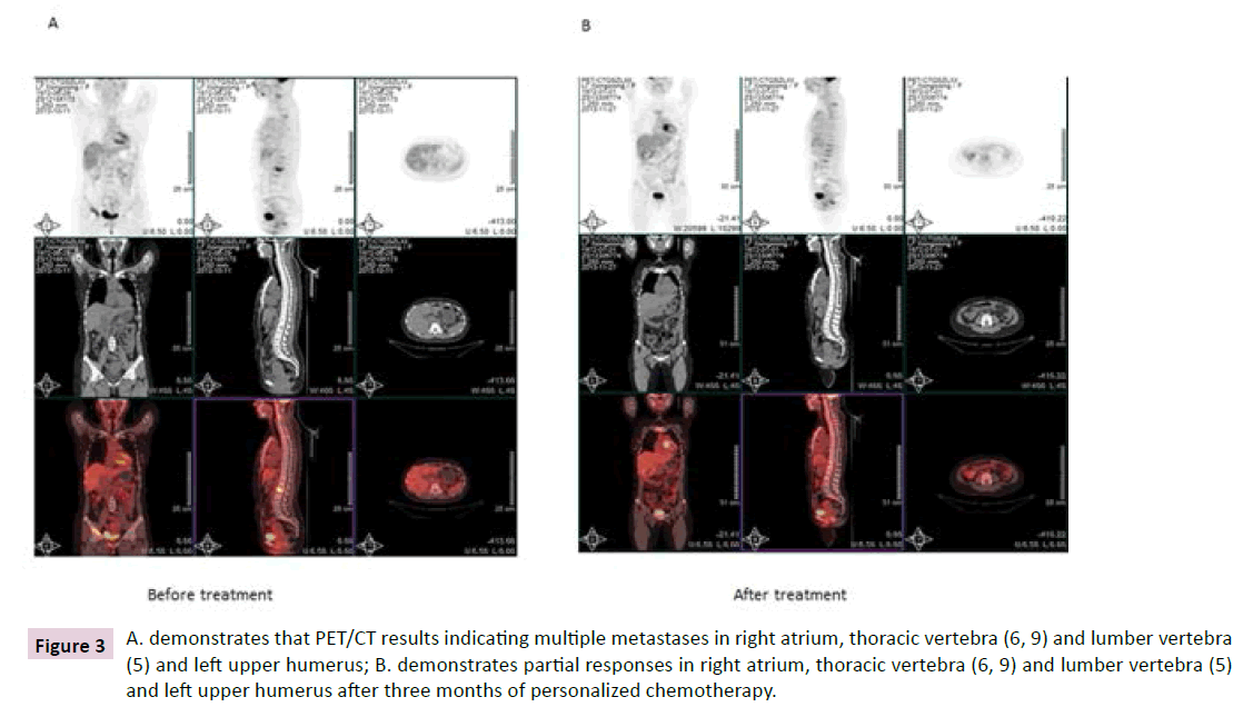 clinical-epigenetics-multiple-metastases