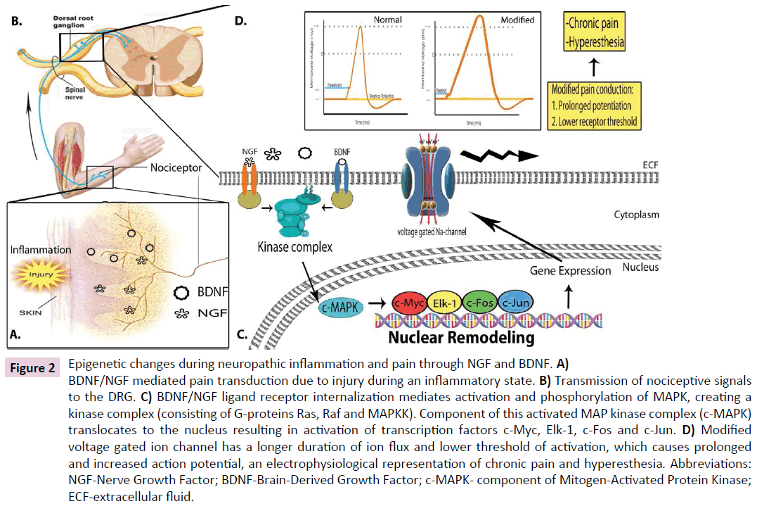 clinical-epigenetics-neuropathic-inflammation