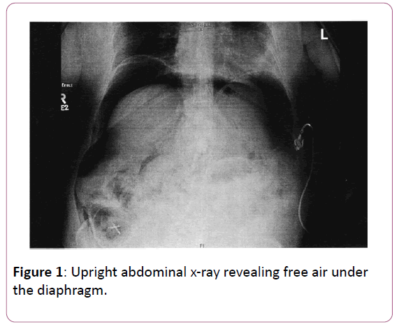 clinical-gastroenterology-Upright-abdominal