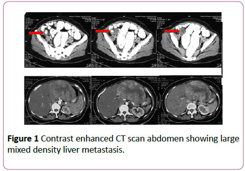 clinical-gastroenterology-hepatology-Contrast-enhanced