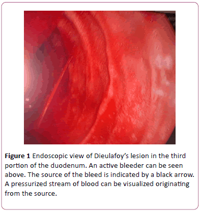 clinical-gastroenterology-hepatology-Endoscopic