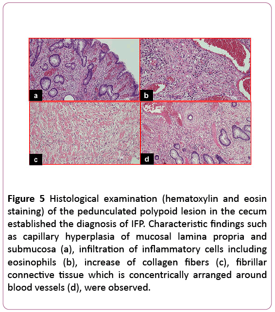 clinical-gastroenterology-hepatology-Histological-examination