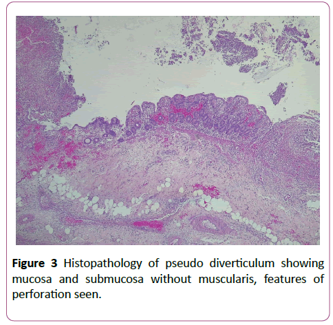 clinical-gastroenterology-hepatology-Histopathology