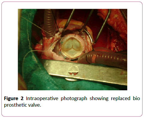 clinical-gastroenterology-hepatology-Intraoperative