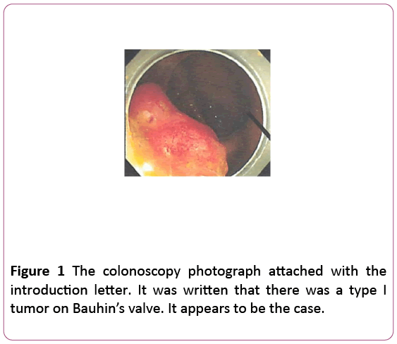 clinical-gastroenterology-hepatology-colonoscopy-photograph