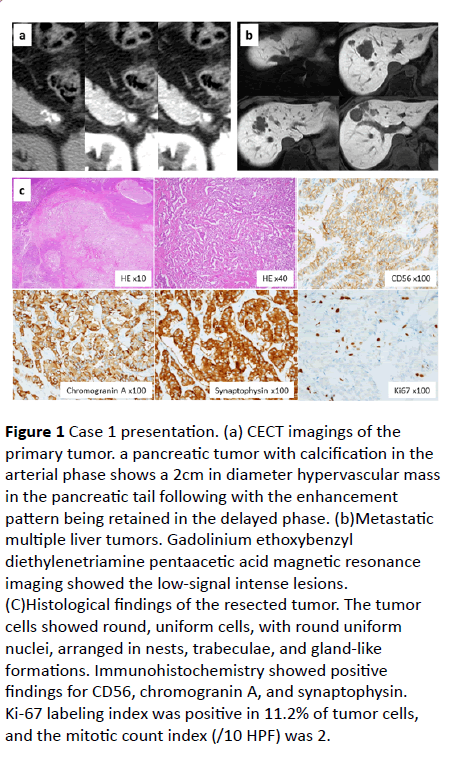 clinical-gastroenterology-hepatology-pancreatic-calcification