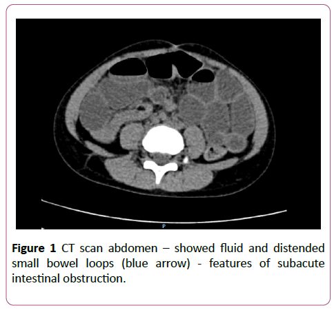 clinical-gastroenterology-hepatology-scan-abdomen