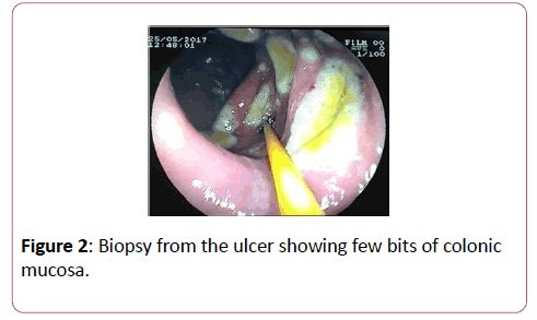 clinical-gastroenterology-hepatology-showing-few-bits