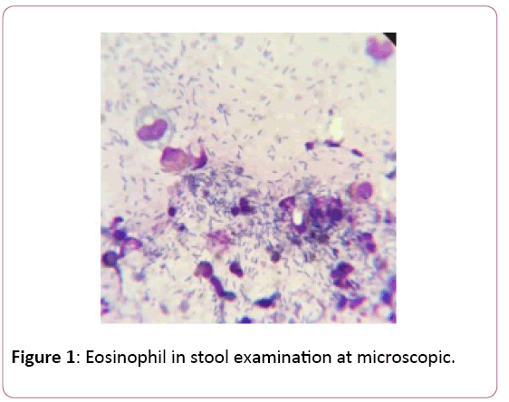 clinical-gastroenterology-hepatology-stool-examination