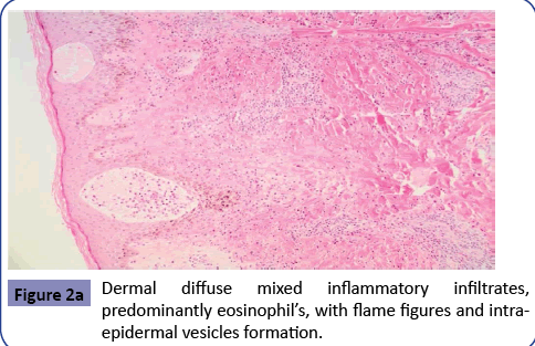 clinical-pediatrics-dermatology-Dermal-diffuse-inflammatory