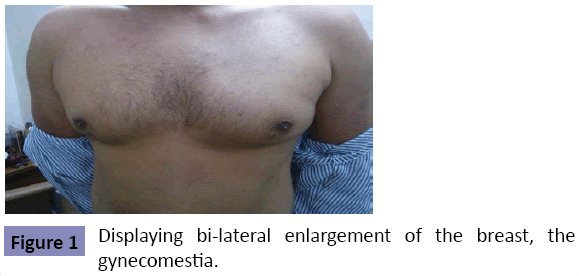 clinical-pediatrics-dermatology-Displaying-bi-lateral-enlargement