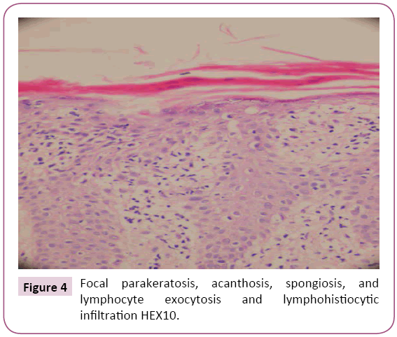 clinical-pediatrics-dermatology-Focal-parakeratosis