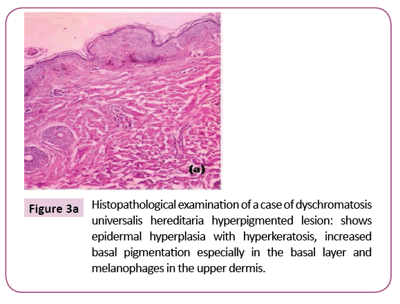 clinical-pediatrics-dermatology-Histopathological-examination