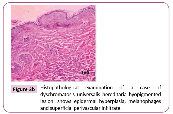 clinical-pediatrics-dermatology-Histopathological-examination