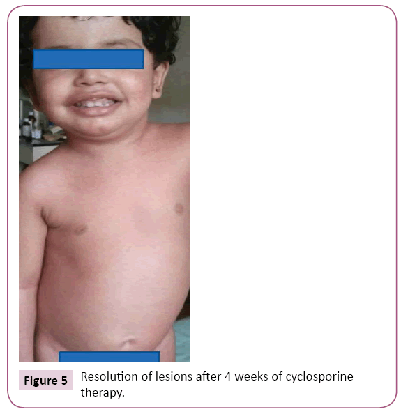 clinical-pediatrics-dermatology-lesions-after