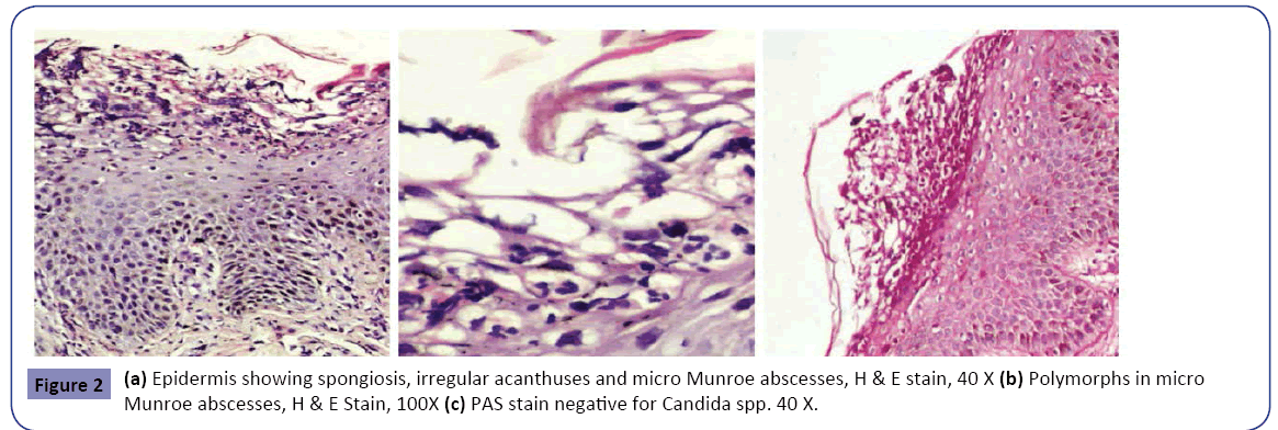 clinical-pediatrics-dermatology-micro-Munroe