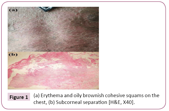 clinical-pediatrics-dermatology-oily-brownish