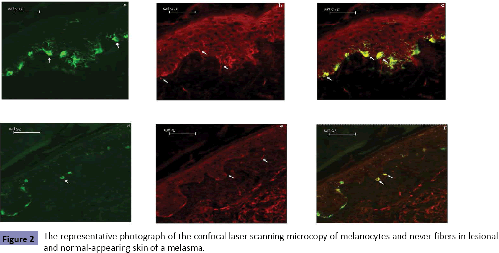 clinical-pediatrics-dermatology-photograph-confocal-laser