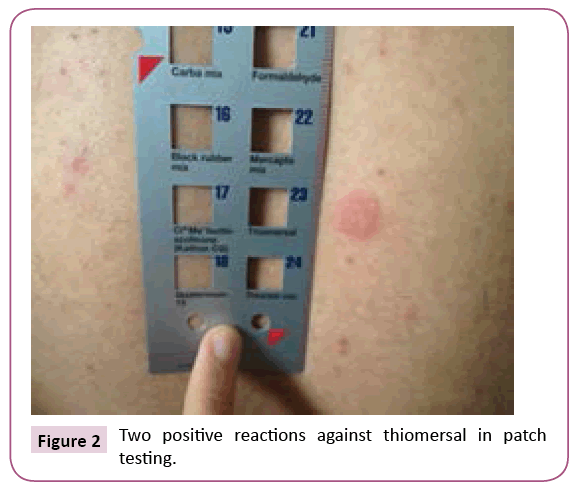 clinical-pediatrics-dermatology-positive-reactions