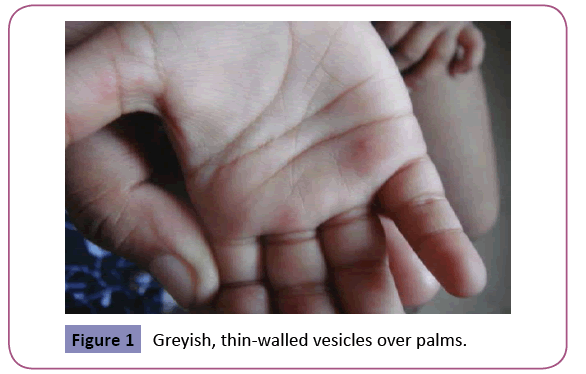 clinical-pediatrics-dermatology-thin-walled