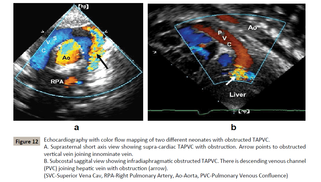 criticalcare-Arrow-points