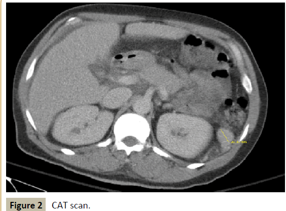 criticalcare-CAT-scan