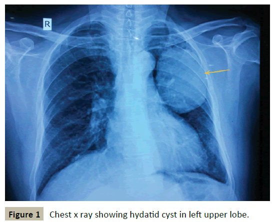 criticalcare-Chest-x-ray