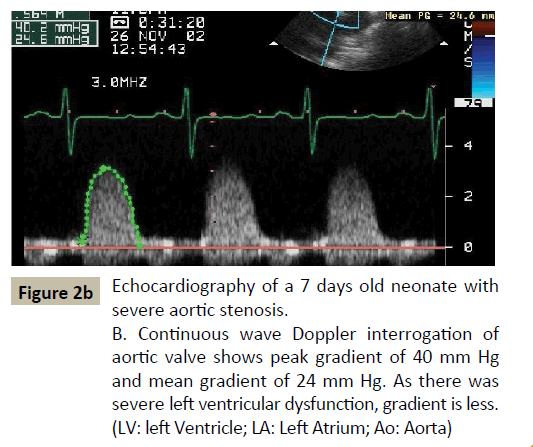 criticalcare-Doppler-interrogation