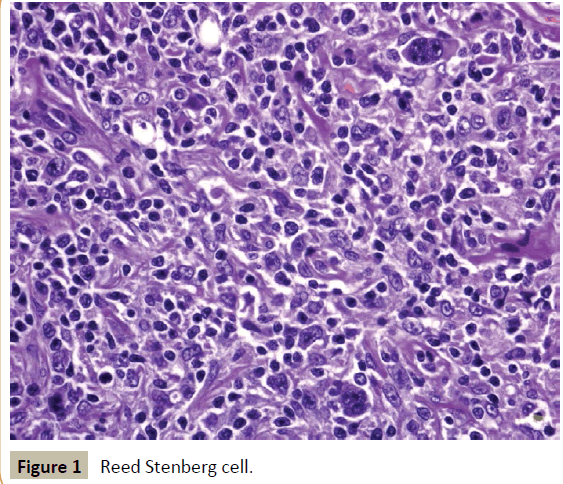 criticalcare-Reed-Stenberg