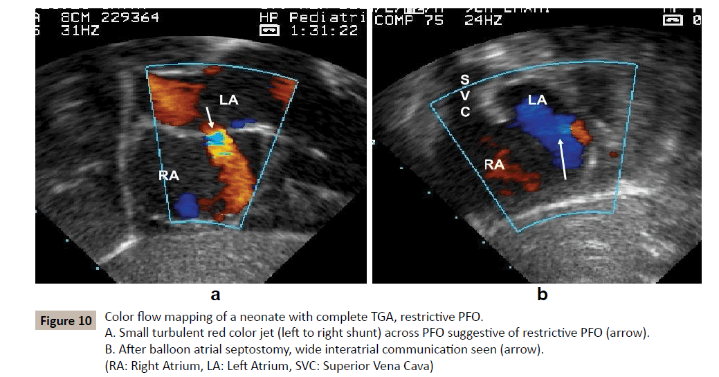 criticalcare-Small-turbulent