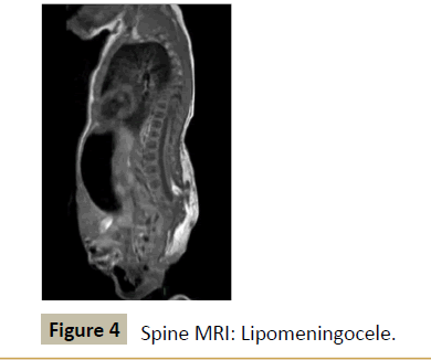criticalcare-Spine-MRI