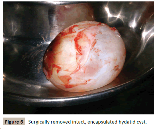 criticalcare-Surgically-removed