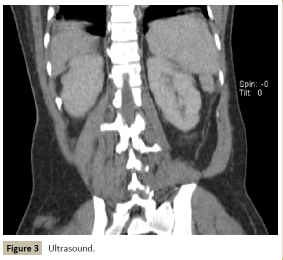 criticalcare-Ultrasound