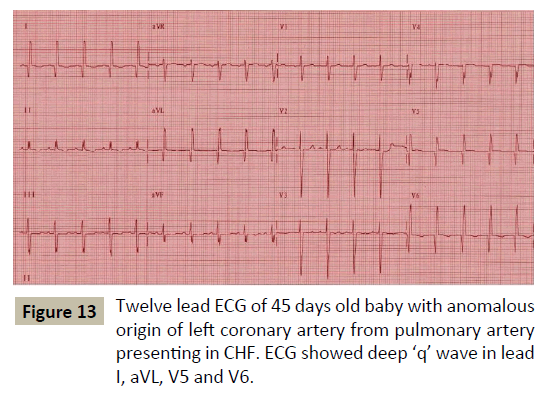 criticalcare-anomalous-origin